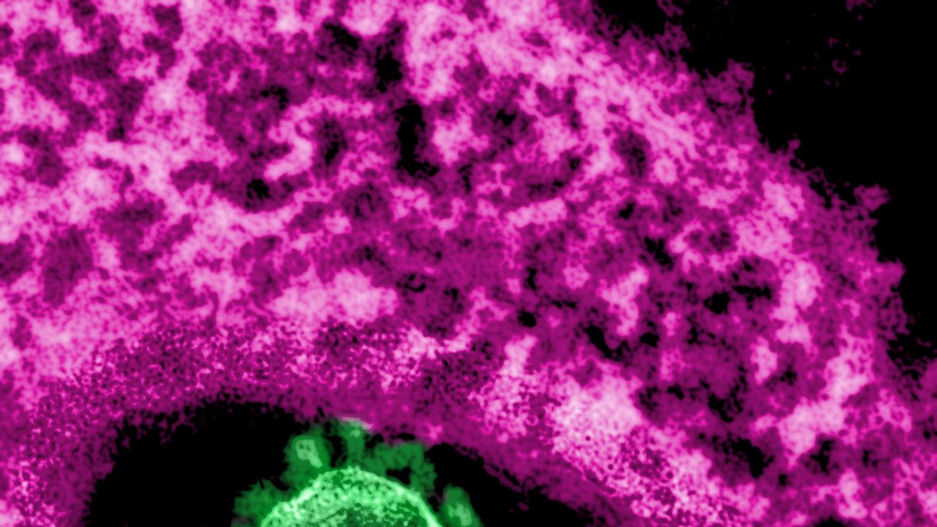 MERS-CoV CORONAVIRUS result scientific imagery MICROSCOPE electronic microscope TEM MEDICINE infection viral infection VIROLOGY VIRUS RNA virus coronaviridae coronavirus MERS-CoV Results Examination technique Examination techniques Investigation technique