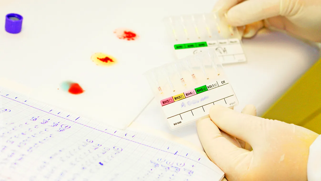 BLOOD GROUP Investigate Inspection Inspect Examining Exam Examine Examinations Investigating Tests testing Medical examinations analysis Analyses Analytical blood analysis Blood testing Blood analyses Blood tests ABO grouping Blood grouping Blood type tes