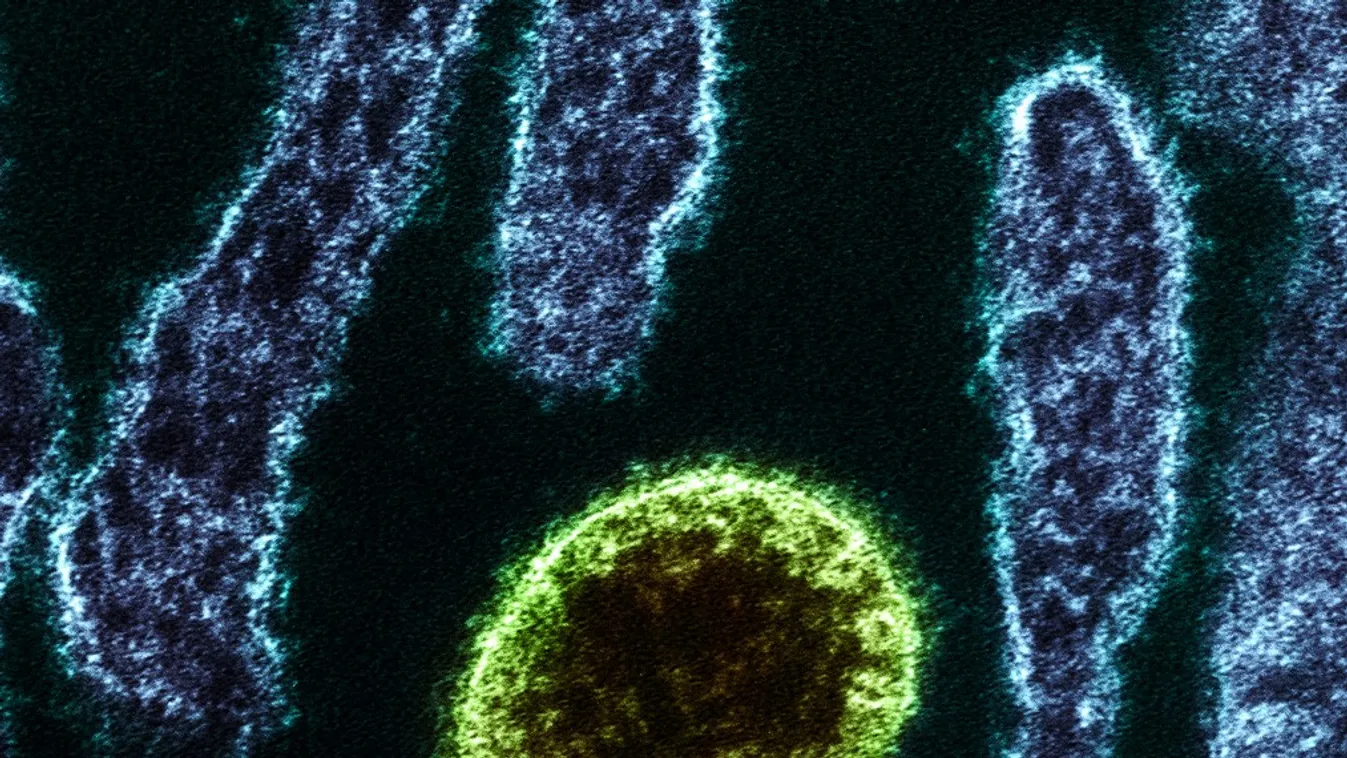 Felvétel egy henipavírusról 