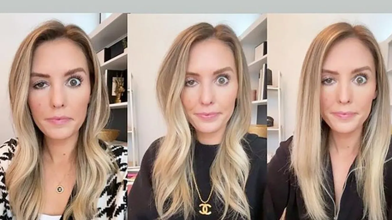 Influencer Candidly Reveals What Happens When Botox Goes Wrong
https://www.instagram.com/stories/highlights/17937827029488893/
whitney buha/instagram 