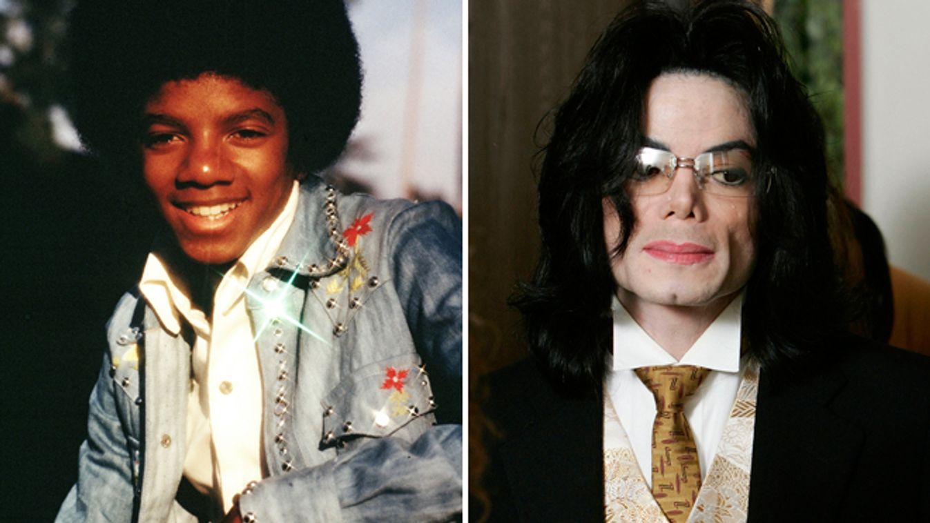 Hírességek, akik 22 éves koruk előtt plasztikáztattak Michael Jackson trend 