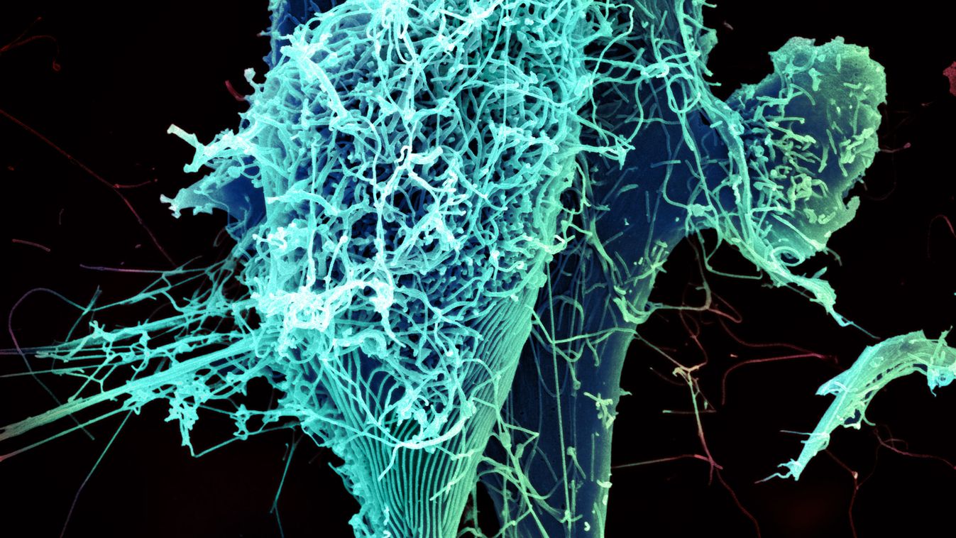 Ebola vírus fertőzött sejt 