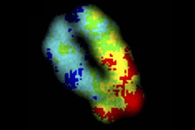 Az emberi kromoszóma DNS-ből és fehérjéből álló kromatinállományának sűrűségét mutató felvétel (vörössel a nagy, kékkel az alacsony sűrűségű részek látszanak)