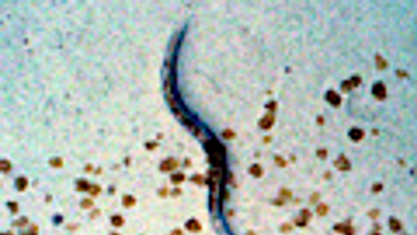 fonálféreg, C. elegans, Caenorhabditis elegans, modellfaj