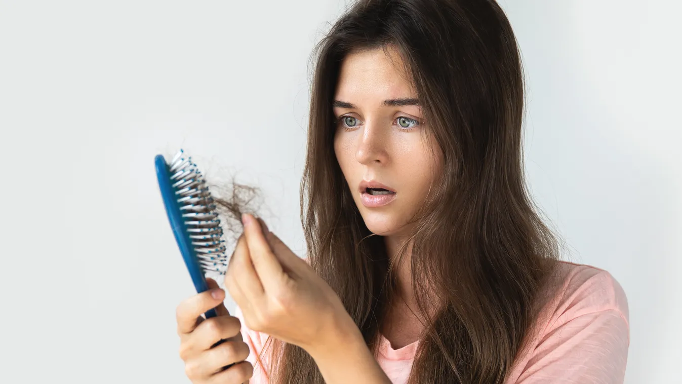Mitől számít kórosnak a hajhullás?  - Ha ezt tapasztalod, fordulj orvoshoz 