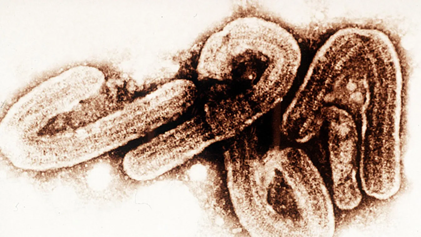 ebola járvány, ebola vírus mikroszkópos képe 