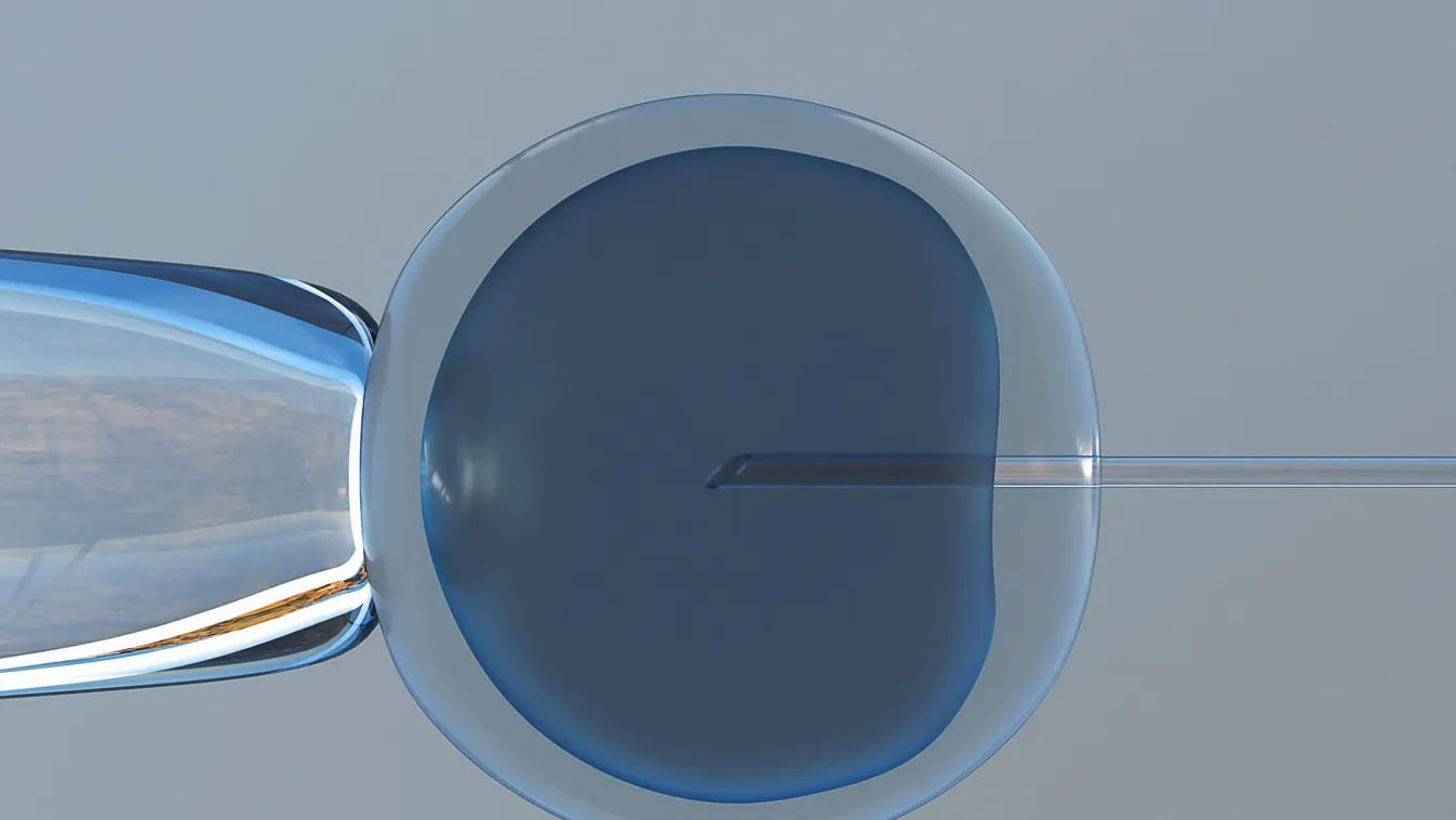 embrió, mesterséges megtermékenyítés 