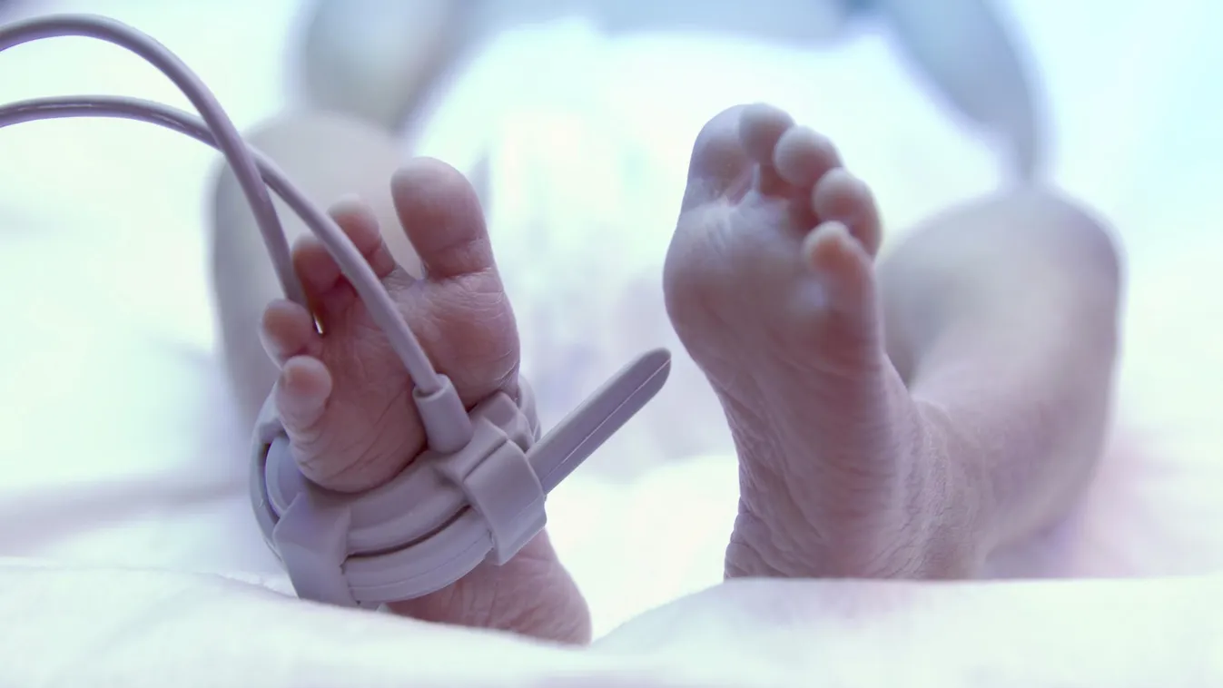kisbaba, koraszülött, kórház, csecsemő, inkubátor 