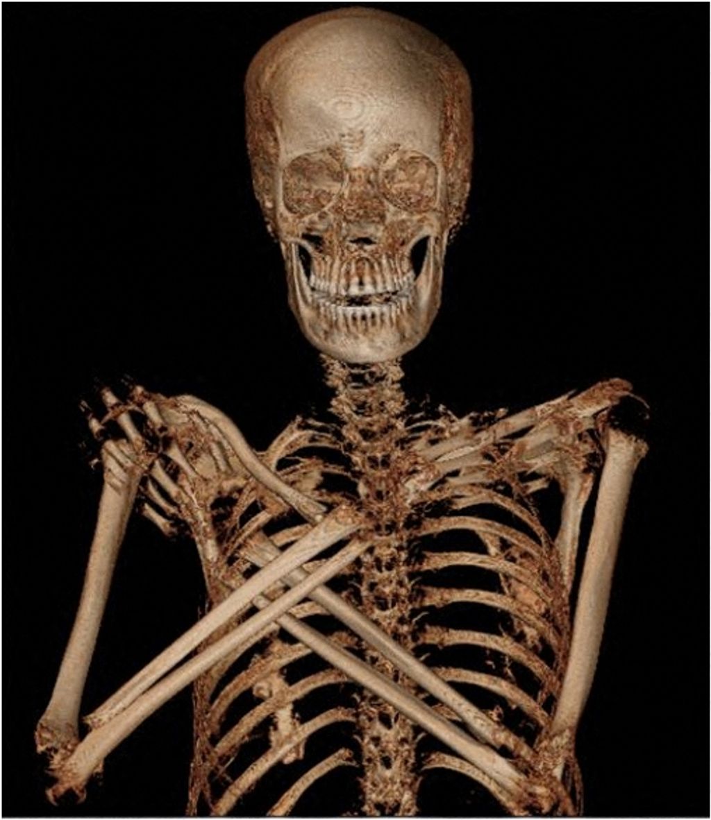 Mummy-to-be: Pregnant embalmed body identified in Poland archaeology Square Vertical 