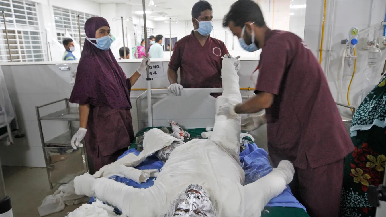 Dakka, 2020. szeptember 5.
Égési sérüléseket szerzett férfit kezelnek egy dakkai kórházban 2020. szeptember 5-én, miután előző nap este robbanás történt, majd tűz keletkezett egy mecsetben a bangladesi főváros közelében. A tűzoltóság szerint feltehetően e