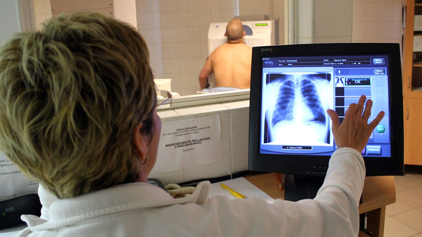 nemzeti szűrőprogram, Matuszné Sárosi Mária röntgen asszisztens (b) tüdőszűrő vizsgálatot végez Majoros Márkon a Miskolci Semmelweis Ignác Egészségügyi Központban 