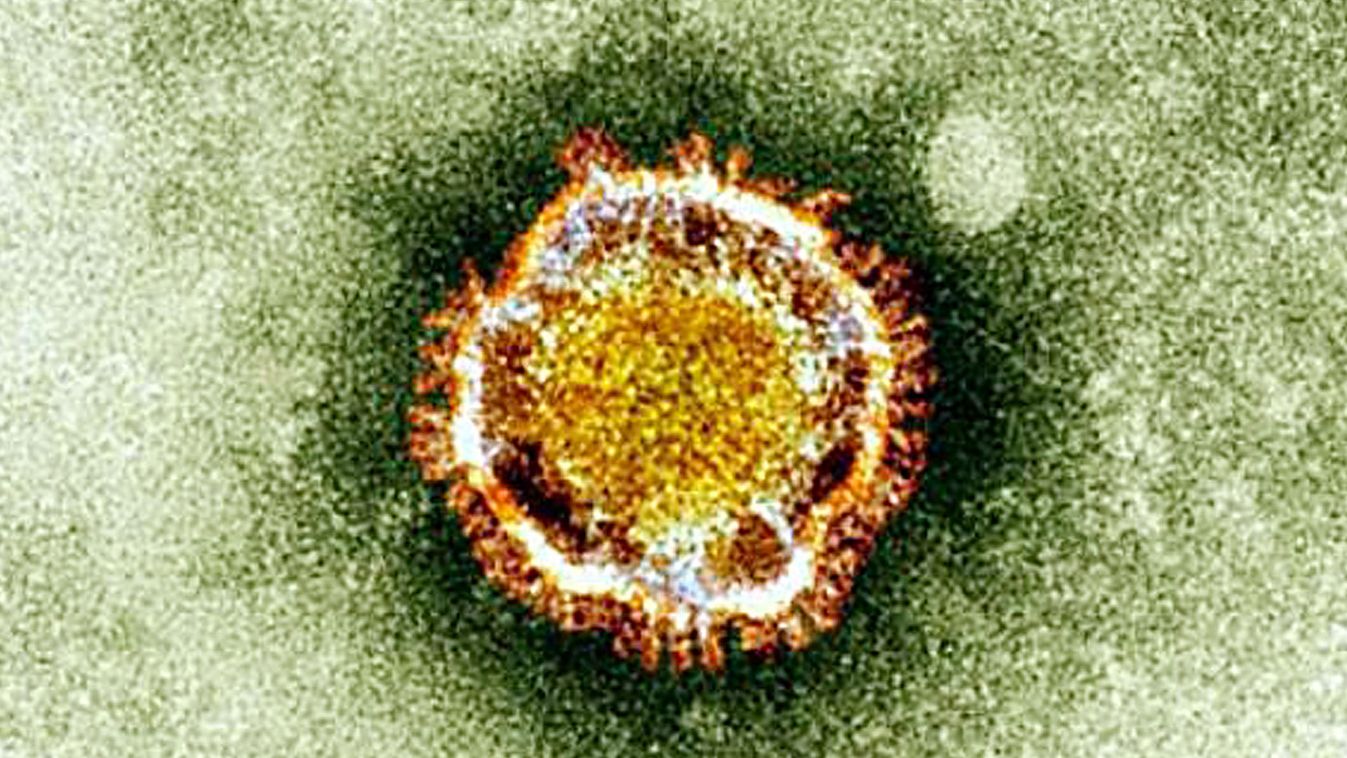 új koronavírus, A brit egészségvédelmi ügynökség által közreadott kép az új koronavírusról, MERS-CoV, Middle East Respiratory Syndrome Coronavirus 