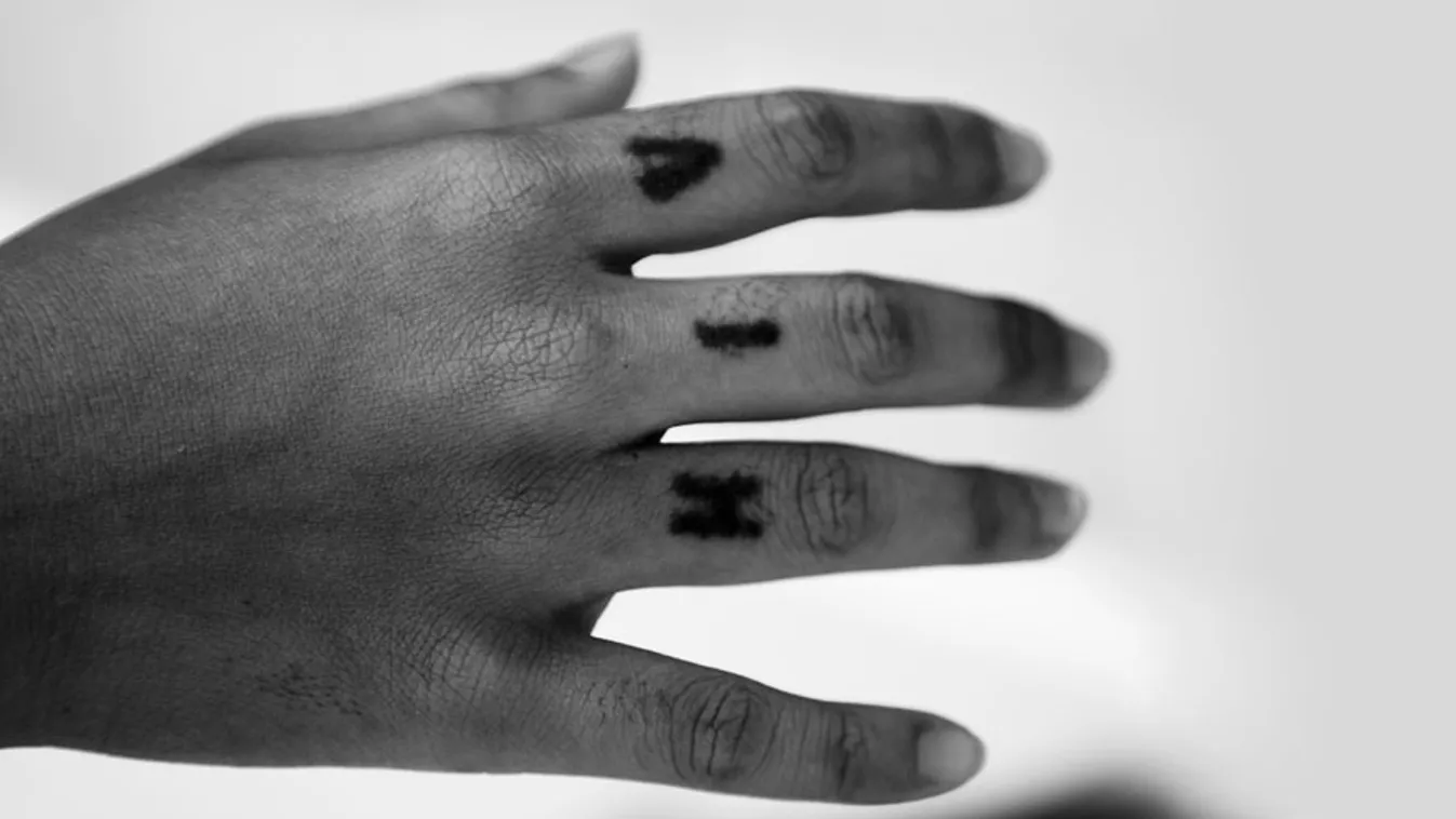 HIV, tetoválás egy HIV-fertőzött kezén