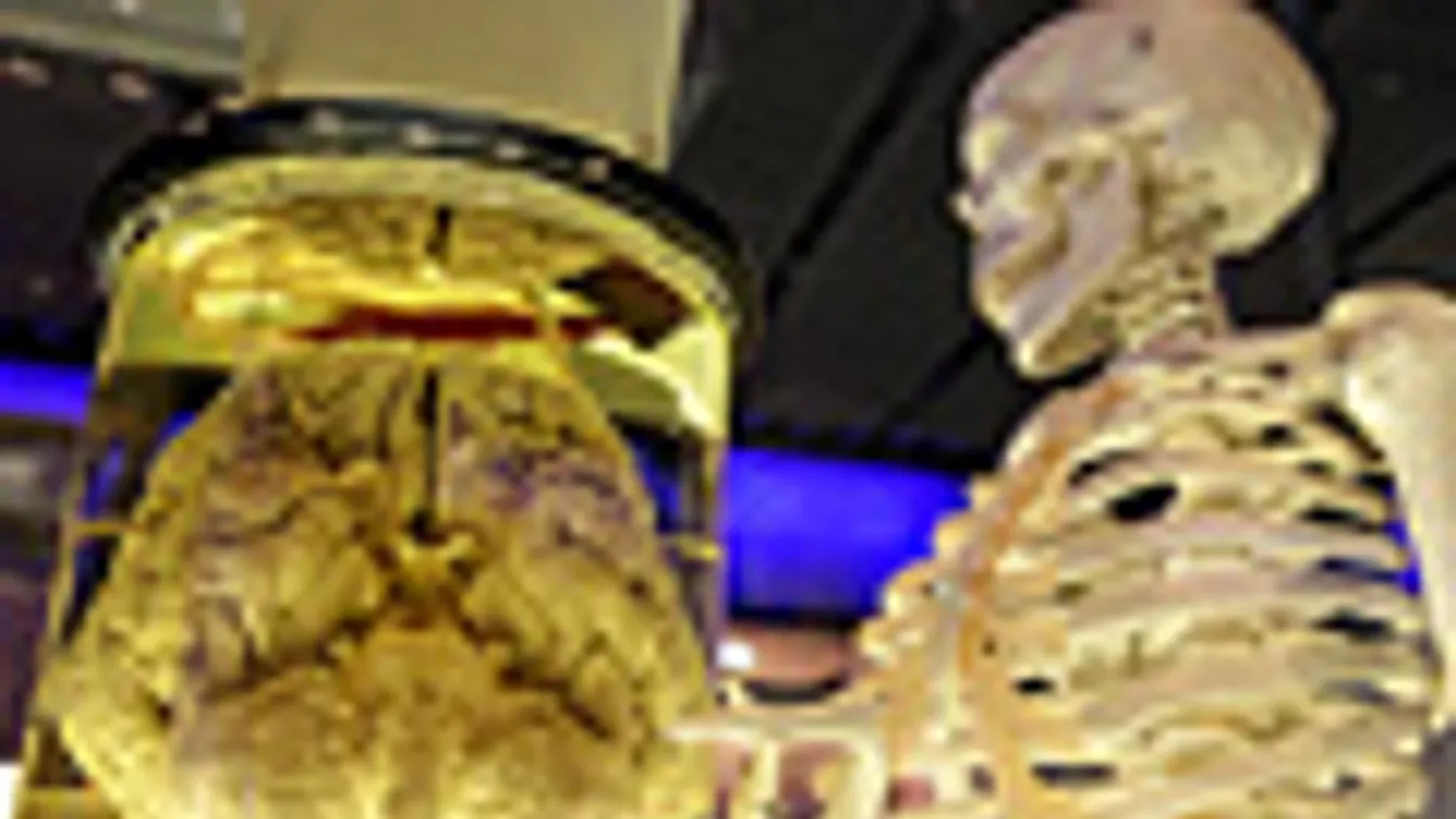 agyhalál, emberi agy és csontváz a Kensington múzeum kórháztörténeti kiállításán