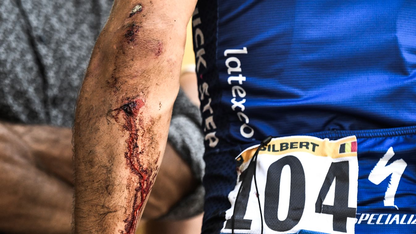Horizontal CYCLING TOUR DE FRANCE FALL CASUALTY CLOSE-UP BLOOD 