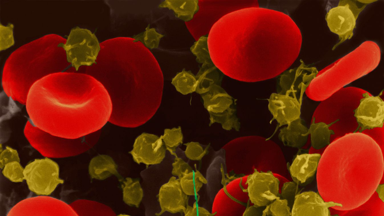 Vörösvérsejtek és vérlemezkék Red blood cells and platelets, SEM 9031a human body BLOOD erythrocyte haemoglobin human platelet red blood cell sem scanning electron micrograph coloured false-coloured colored false-colored thrombocyte thrombocytes 