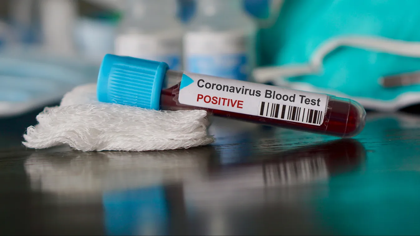 coronavirus pozitiv kémcső vérminta, koronavírus, illusztráció 