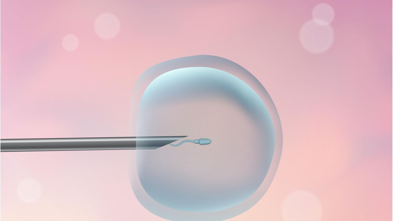 mesterséges megtermékenyítés, embrió 