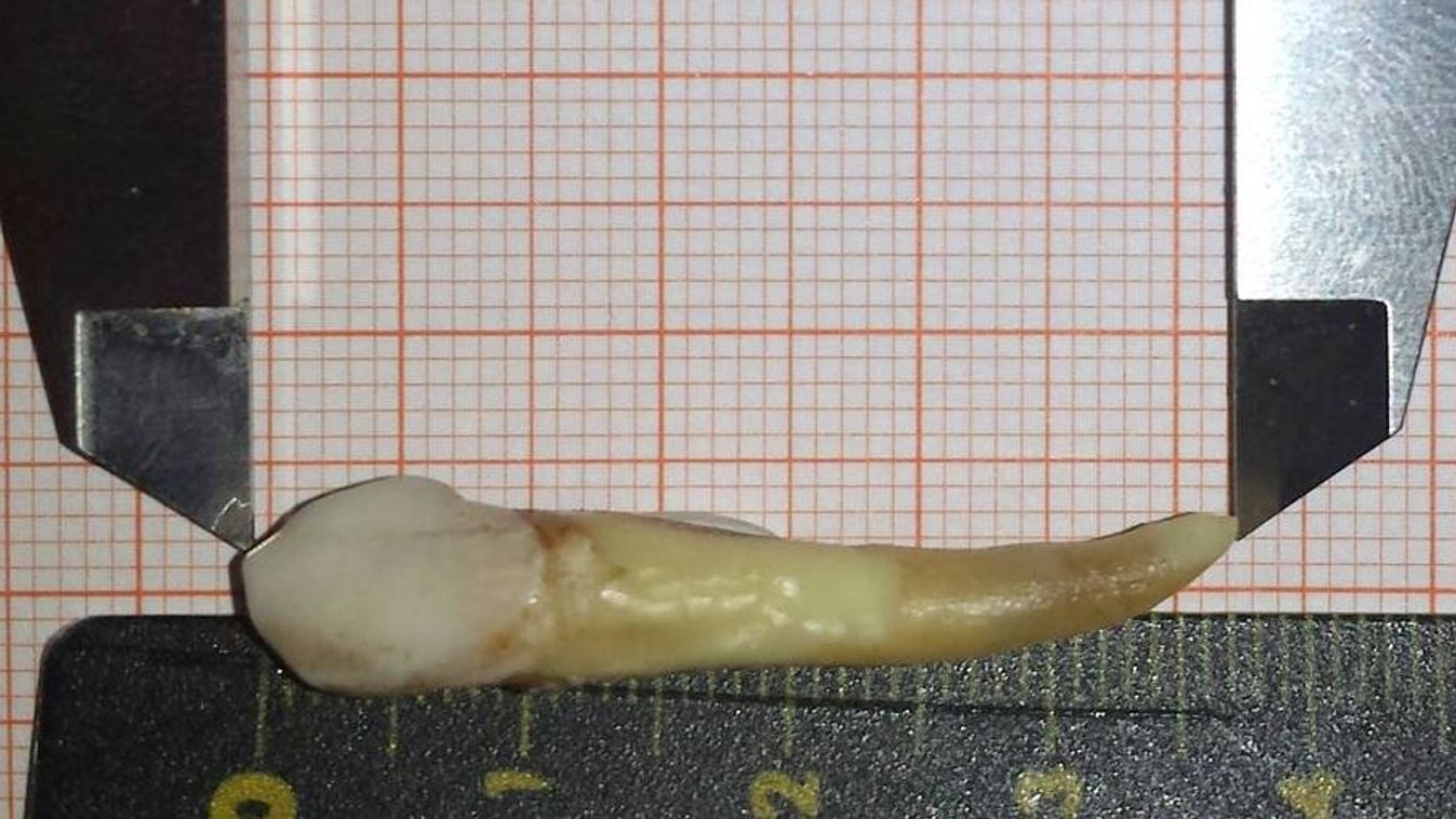 Guinness Világrekord, fogorvos, 37,2 milliméter, emberi fog, fog, Németország, Lengyelország 