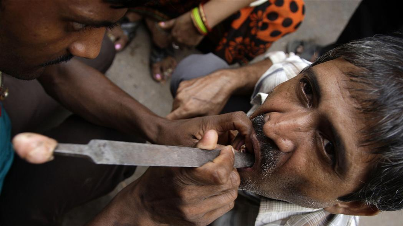 betegség utazás közben, utcai fogorvos az indiai Varanasiban 
