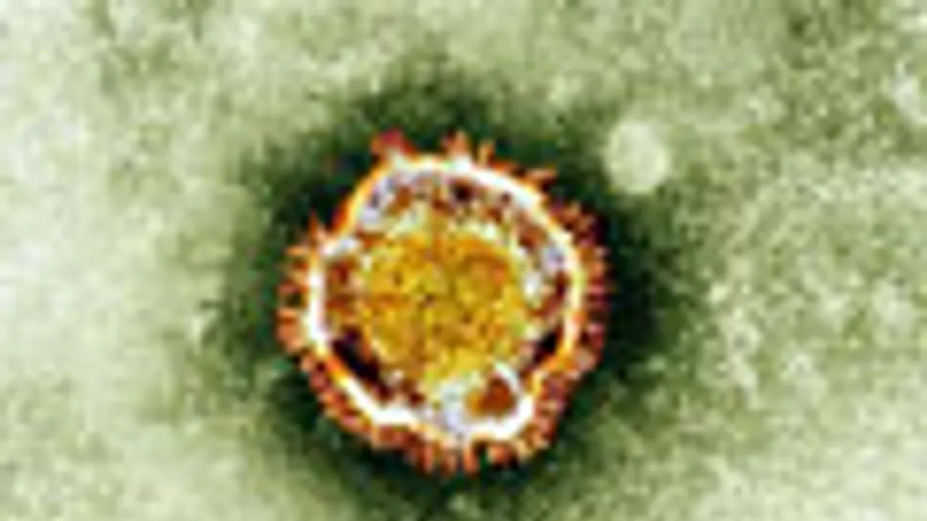 új koronavírus, A brit egészségvédelmi ügynökség által közreadott kép az új koronavírusról