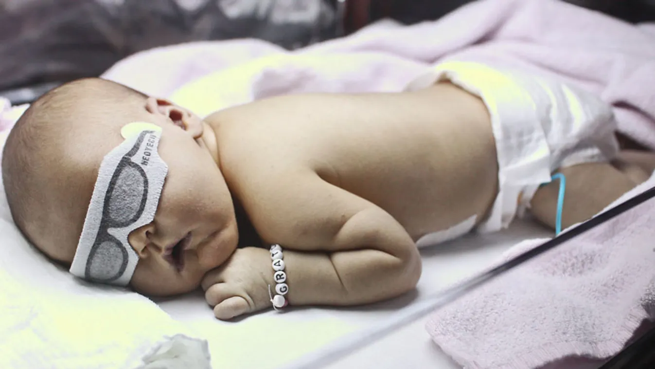 Látássérült, újszülött, koraszülött, csecsemő. Ötnapos csecsemő szemvédő maszkban a sárgaság ellen alkalmazott UV-terápia alatt, 2011. február.