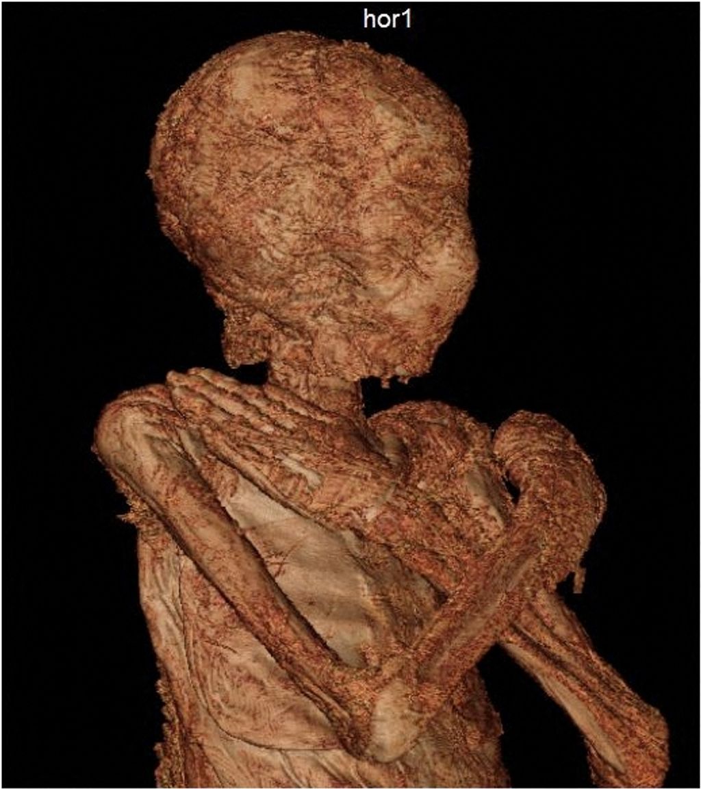 Mummy-to-be: Pregnant embalmed body identified in Poland archaeology Square 