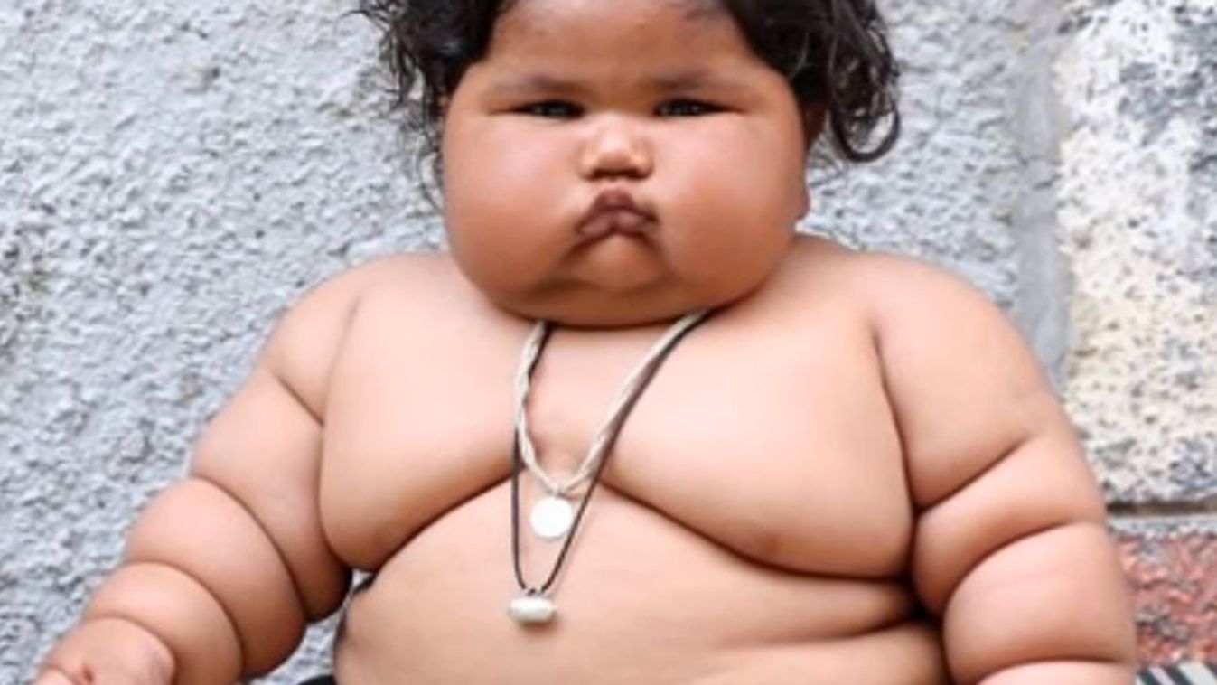 elhízott kislány, India, kövér gyerek, elhízás, túlsúly 