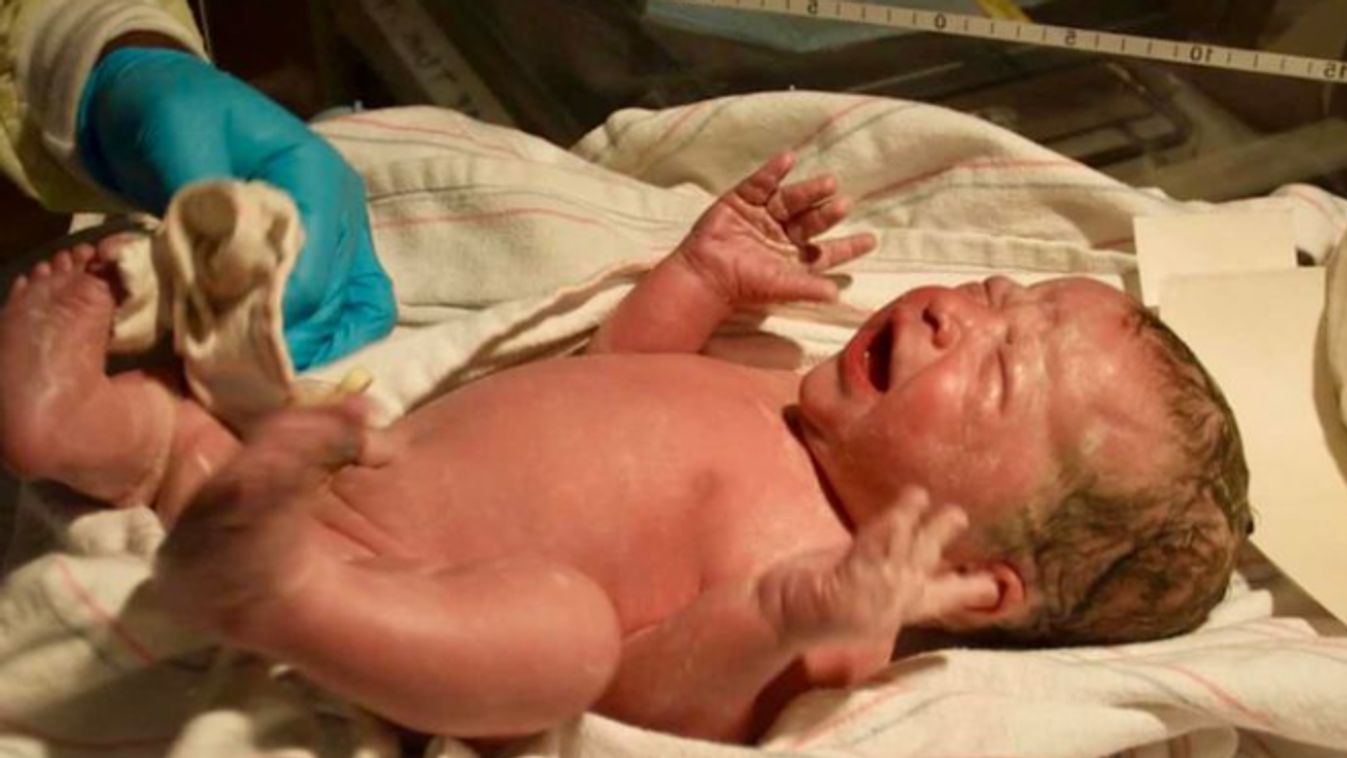 mentők újszülött csecsemő szülés 