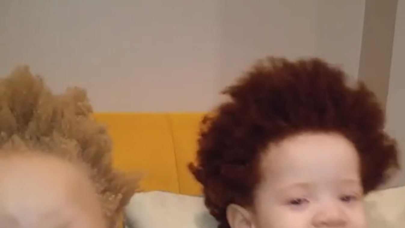 albínó, fekete albínó, albinizmus 