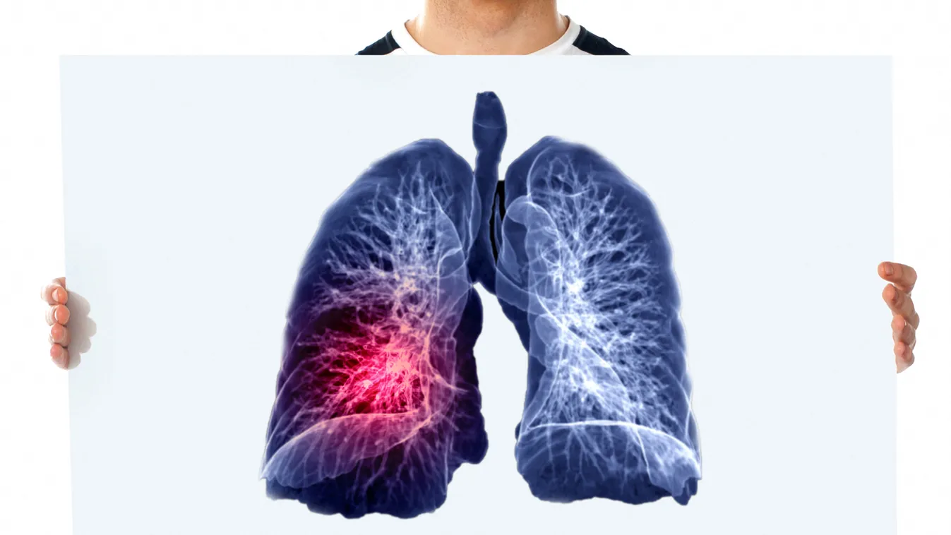 tüdő, légzés, légzőszerv 