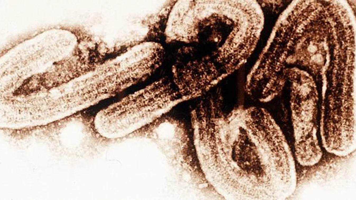 ebola járvány, ebola vírus mikroszkópos képe 