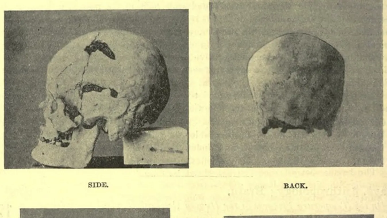 Szanaht feltételezett koponyája 