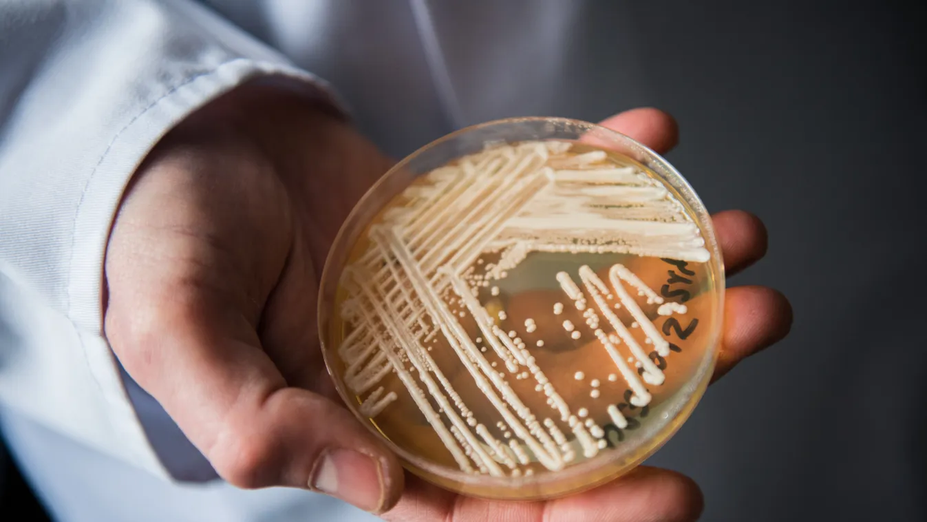 Experts warn of newly-discovered yeast MEDICINE AND HEALTH SCIENCE BAY lby Unterfranken yeast Candida auris 