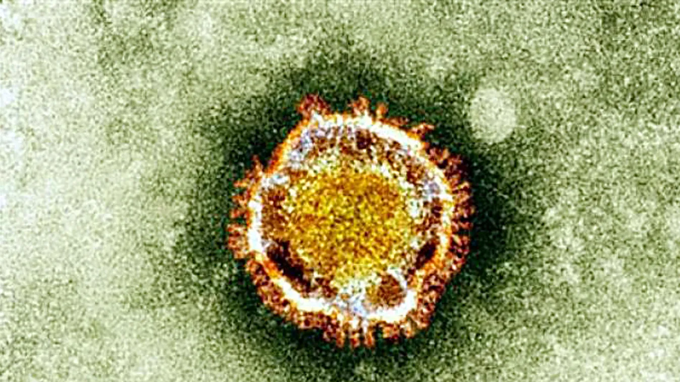 új koronavírus, A brit egészségvédelmi ügynökség által közreadott kép az új koronavírusról, MERS-CoV, Middle East Respiratory Syndrome Coronavirus 