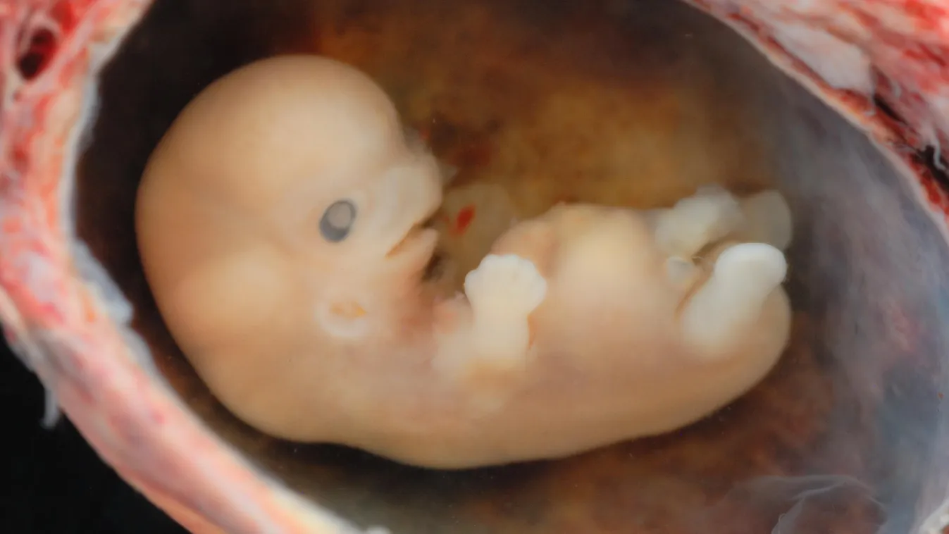 8 hetes embrió 
