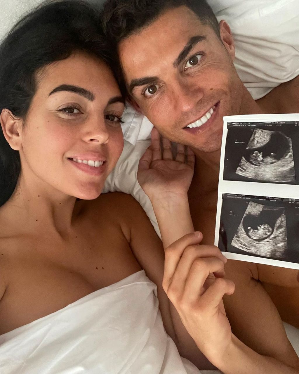 Cristiano Ronaldo felesége ikreket vár 
