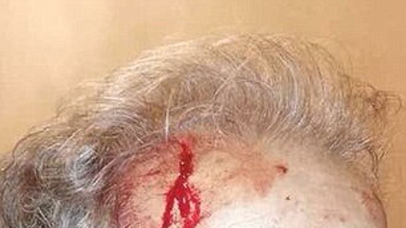 Nuccio Garozzo, Catania, borotvapengével támadták meg, rendőrfőkapitány 
