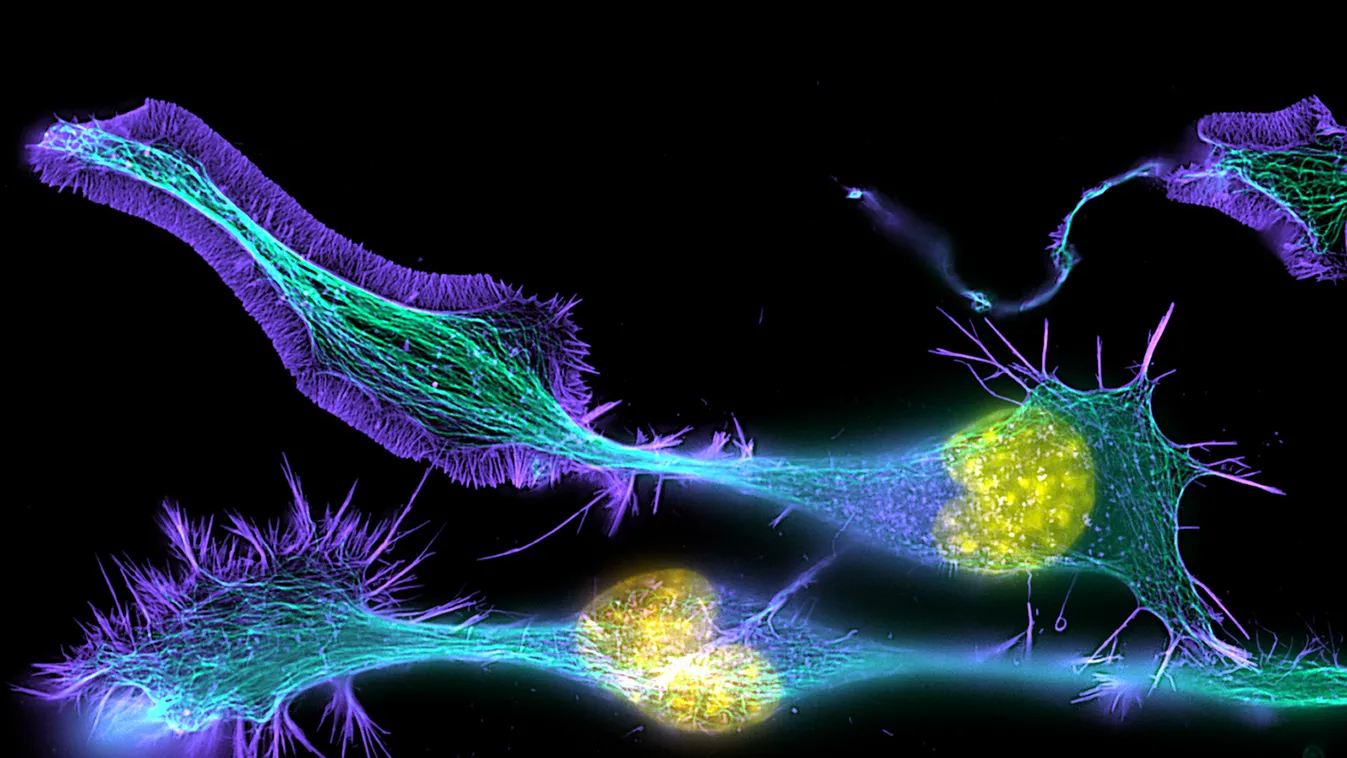 lifemagnified idegsejt axon 
