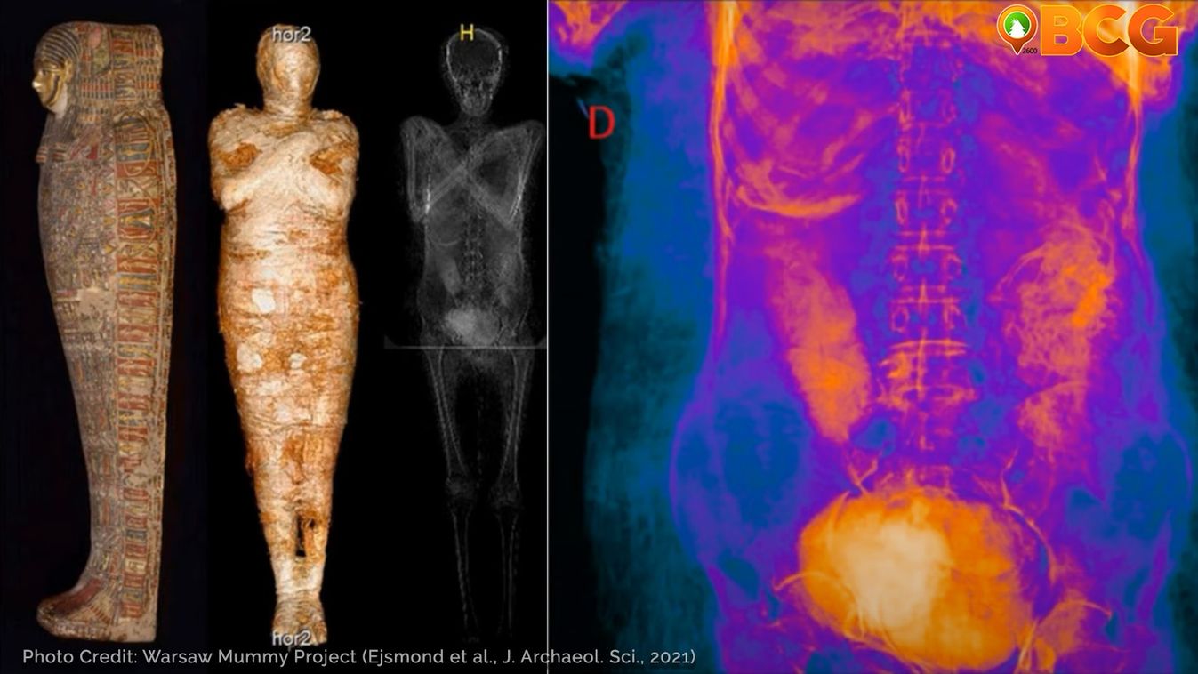 múmia, várandós, mumifikálódott 