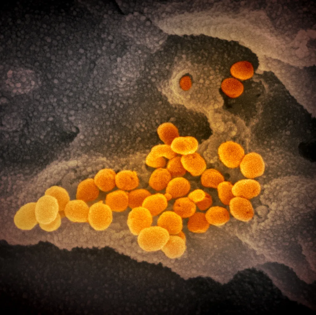 koronavírus, fertőzés 