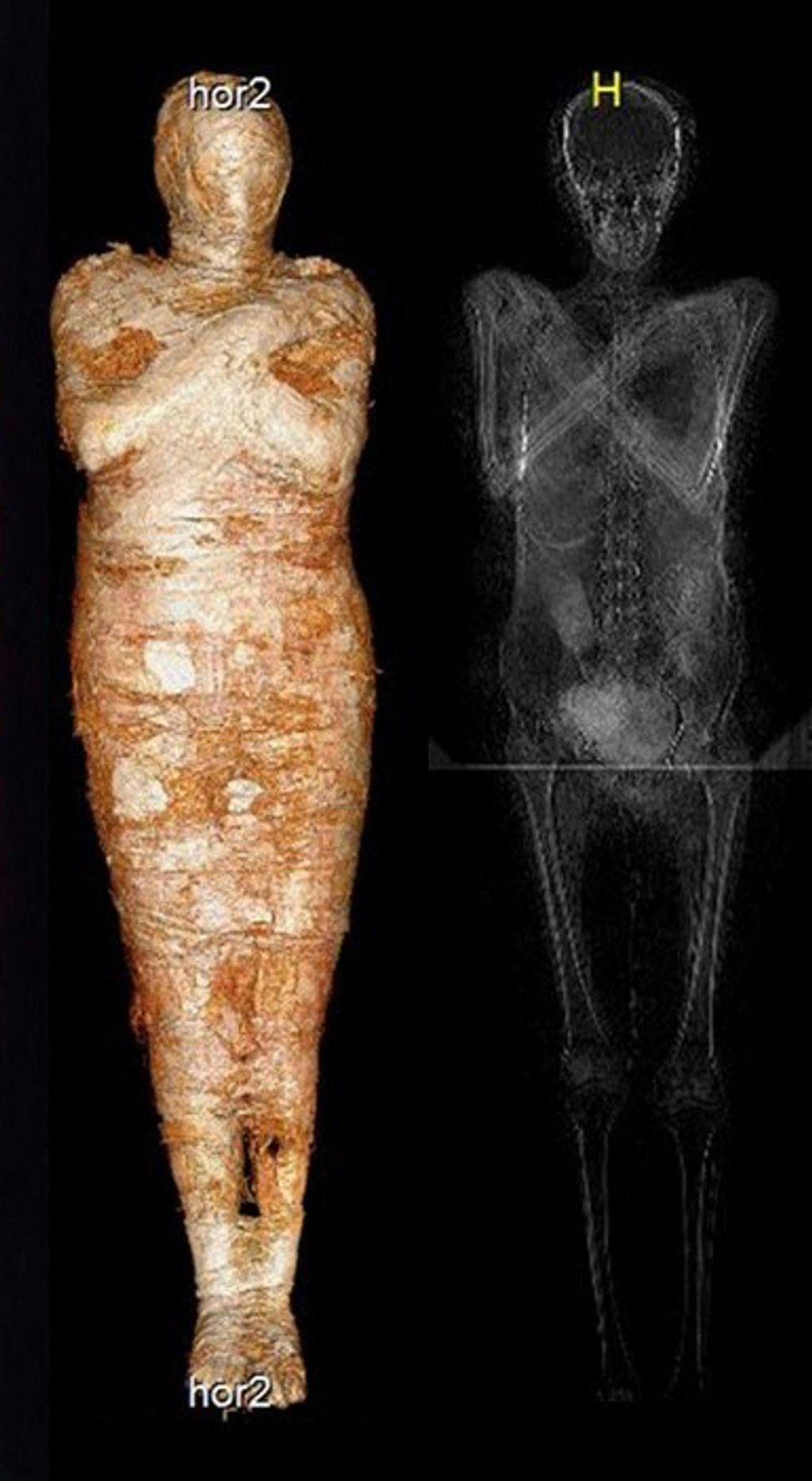 Mummy-to-be: Pregnant embalmed body identified in Poland archaeology Vertical verticalstrip 