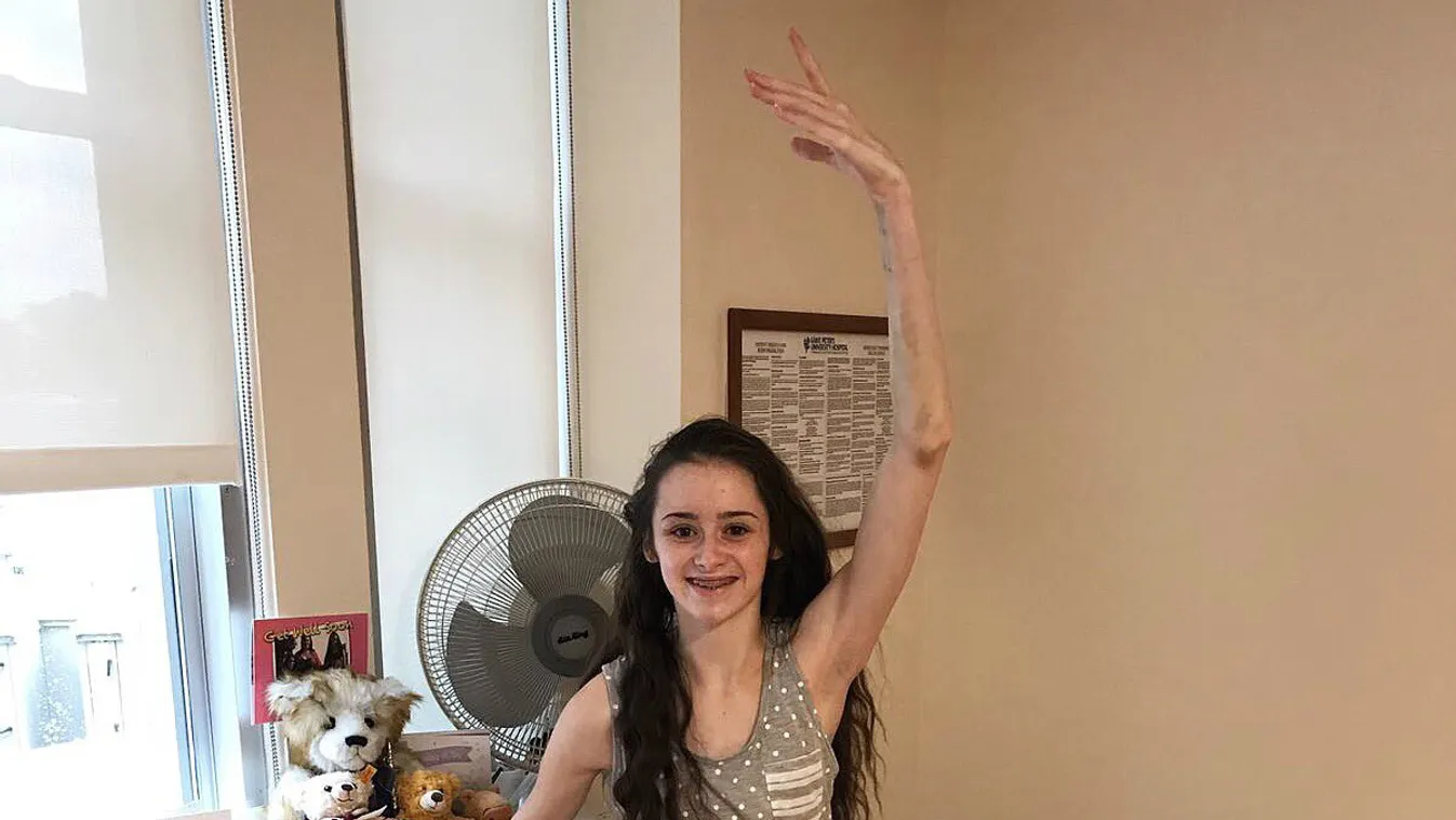 Julia Carlile táncos kislány, akinek Simon Cowell fizette a műtétjét 