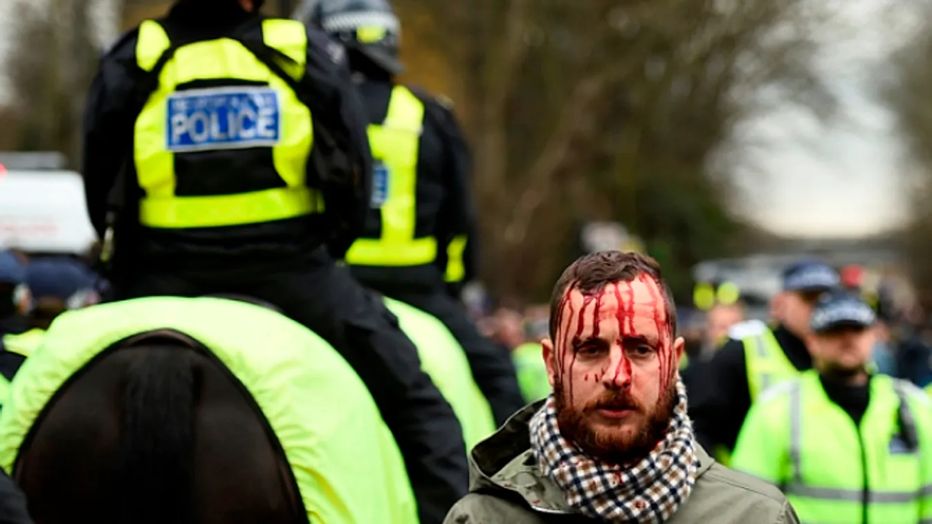 SOC SPO CRIM, 2016, Soccer, optaMatchId:803442, S Football Soccer - Tottenham Hotspur v Arsenal - Barclays Premier League - White Hart Lane - 5/3/16
 Police and a fan with a head injury outside the ground before the match
 Reuters / Dylan Martinez
 Livepi