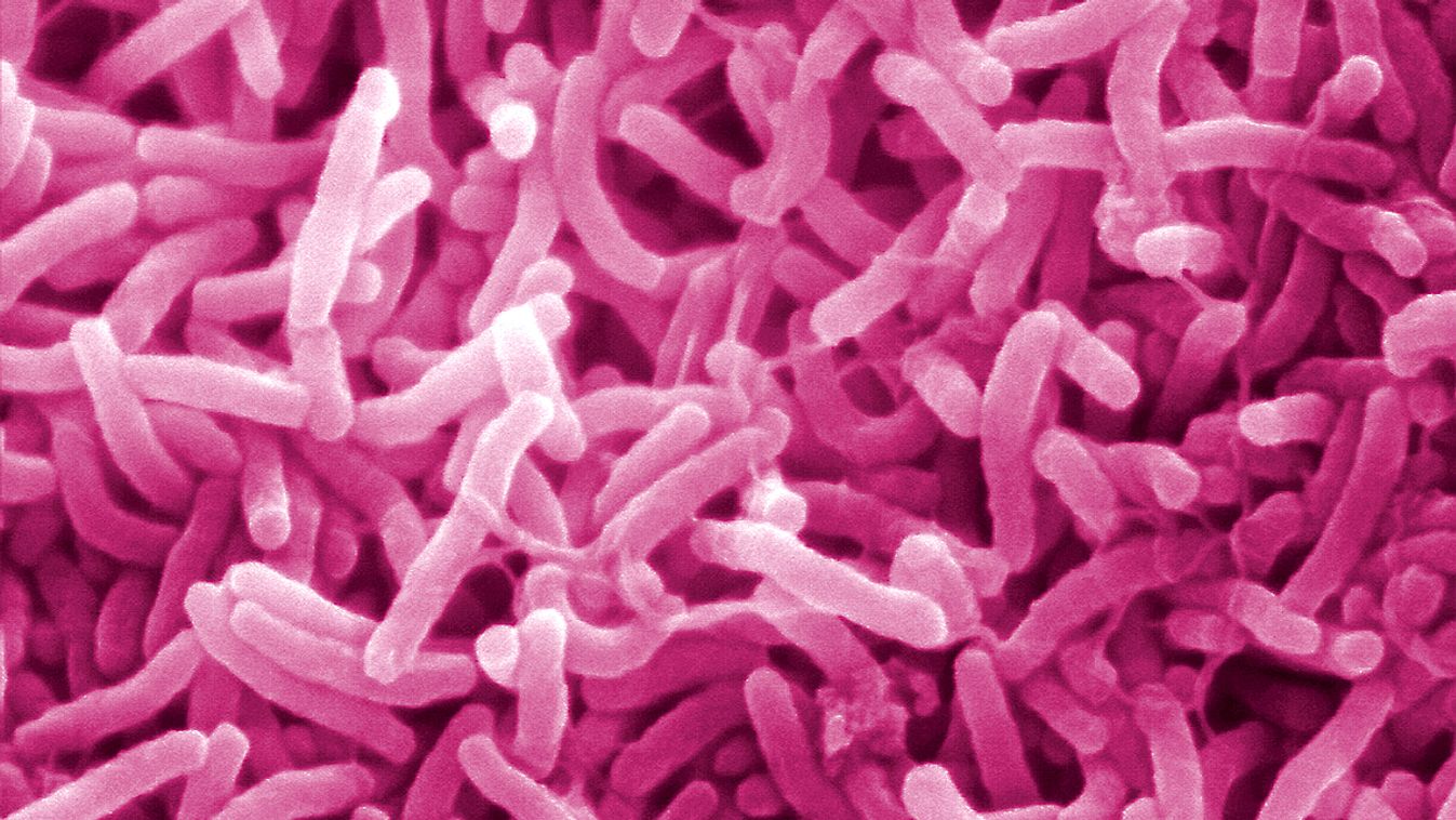 A történelem legpusztítóbb betegségei: a kolera
A Vibrio cholerae nevű baktérium 