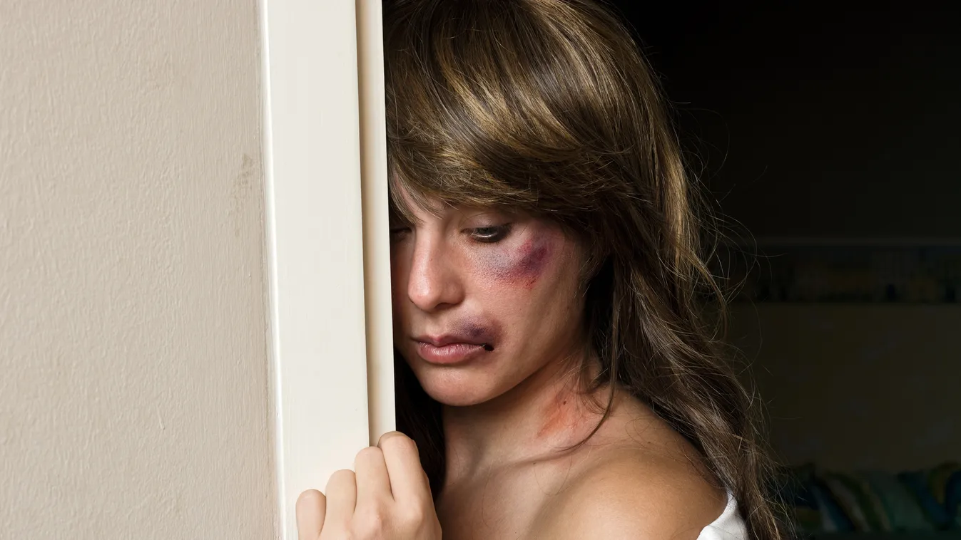 woman with bruises hiding behind wall Abuse Accident Adult Aggression Beaten Up Black Eye Bruise Caucasian Despair Domestic Violence Expressing Negativity Hitting Human Face Pain People Physical Injury Solitude Swollen Victim Violence Women Wound woman wi