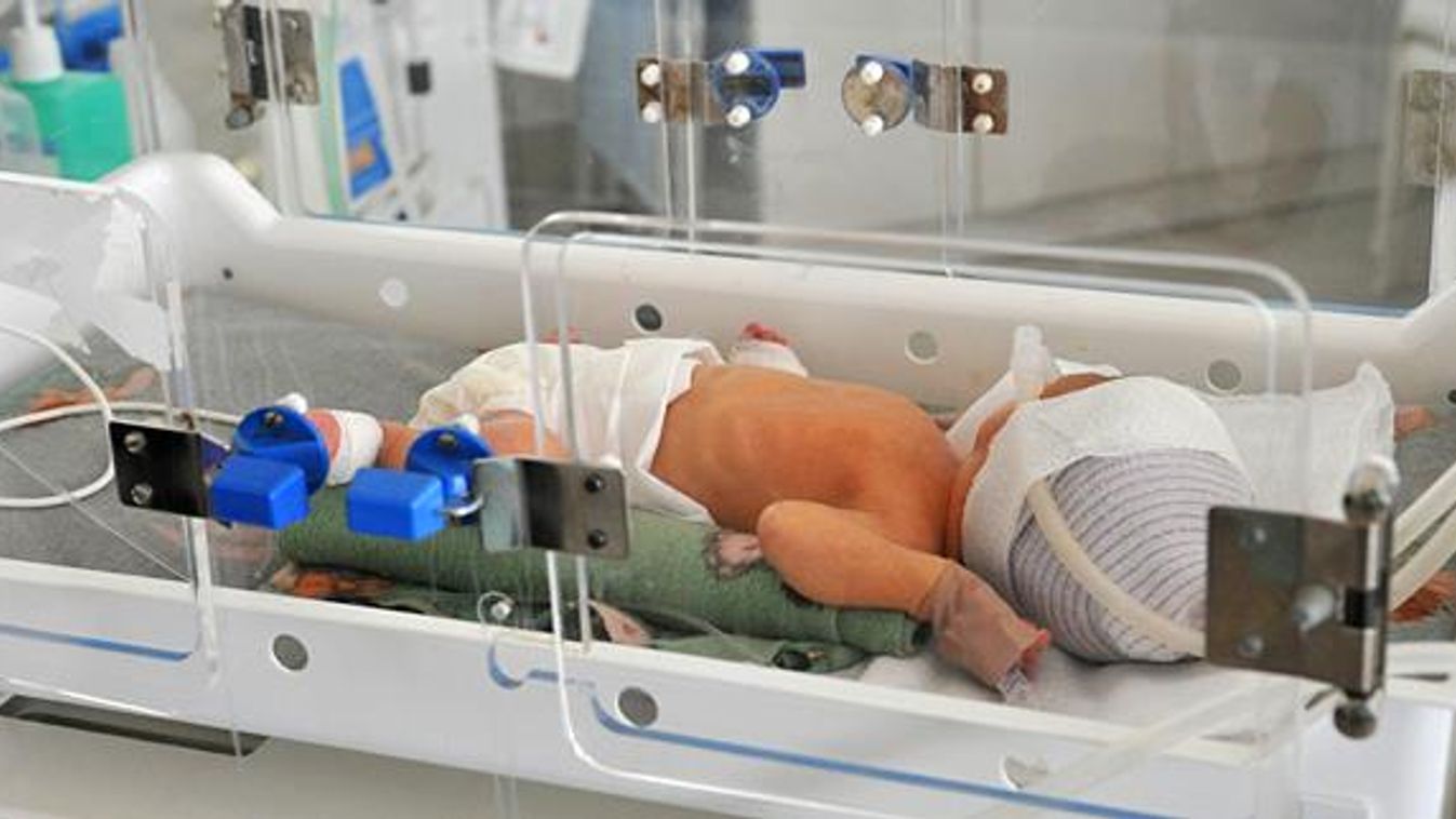 csökken a csecsemőhalandóság MO-on, újszülött, koraszülött, csecsemő, babak, inkubátor 
