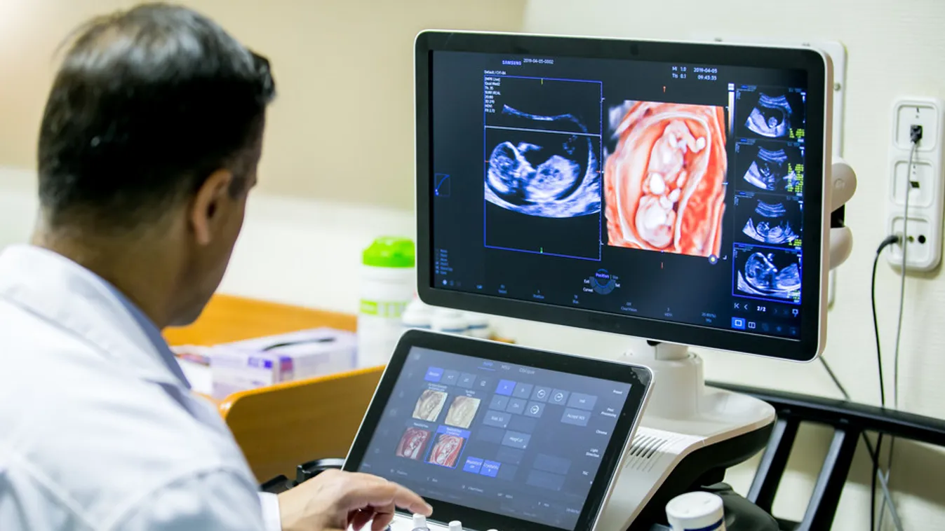 Legmodernebb ultrahangkészülék a Semmelweis Egyetemen 
