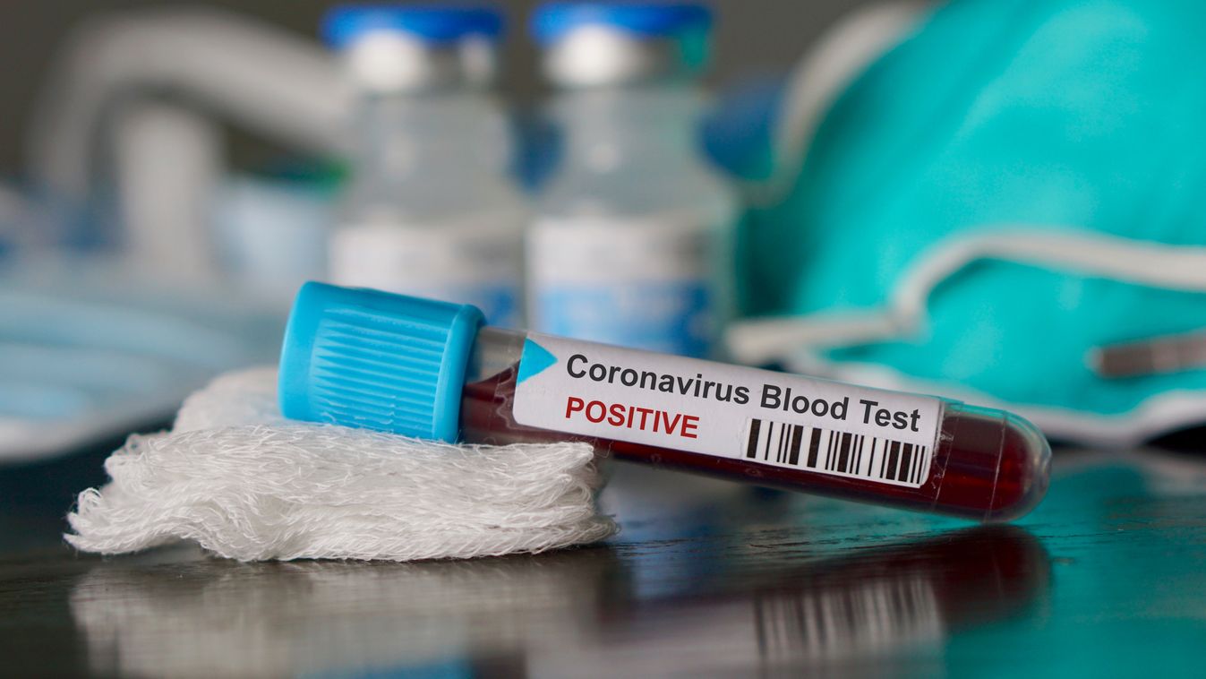 coronavirus pozitiv kémcső vérminta, koronavírus, illusztráció 