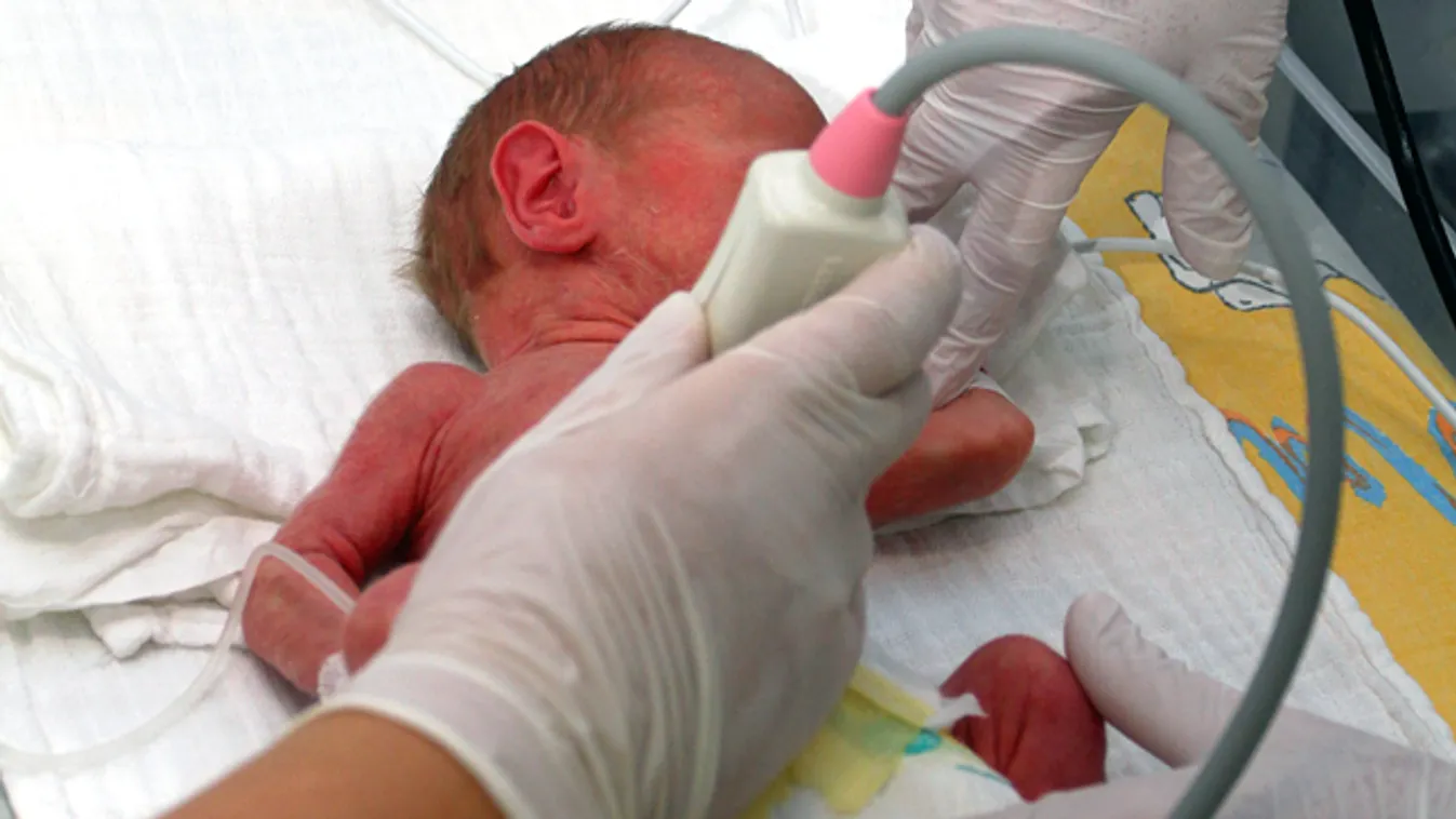 Egy újszülött babát vizsgálnak a Borsod-Abaúj-Zemplén Megyei Kórházban egy ultrahang készülékkel